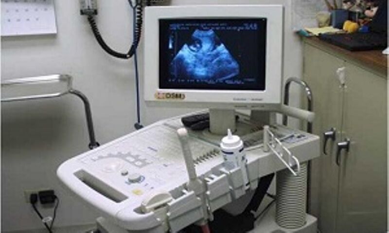 دستگاه سونوگرافی ایرانی تولید شد