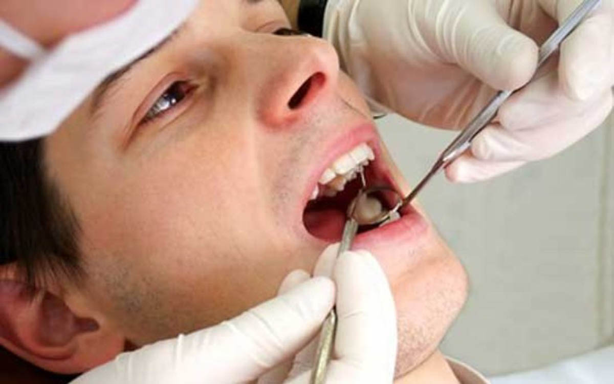 پاکسازی پلاک دهان بدون استفاده از دارو